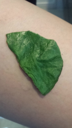 腕のニキビにツワブキの葉を貼りました。