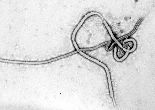 pub_wiki_Ebola_virus09.jpg