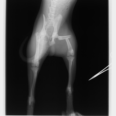 大腿骨(ふとももの骨)の骨折　　手術前